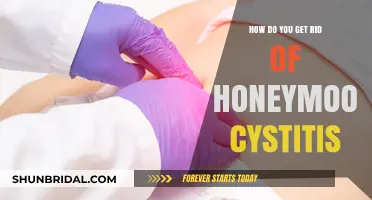 Effective Remedies to Treat Honeymoon Cystitis and Prevent Recurrence