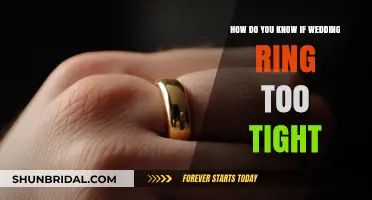Wedding Ring: Too Tight to Fit?