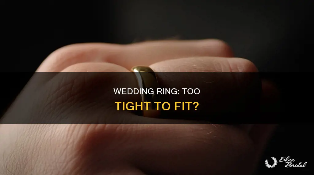 how do you know if wedding ring too tight