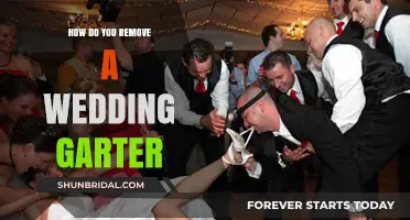 Effortless Steps to Remove Your Wedding Garter with Ease