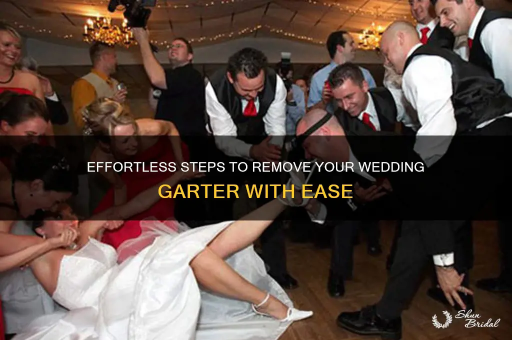 how do you remove a wedding garter