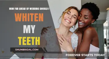 Perfect Smile Timeline: When to Whiten Teeth Before Your Wedding Day