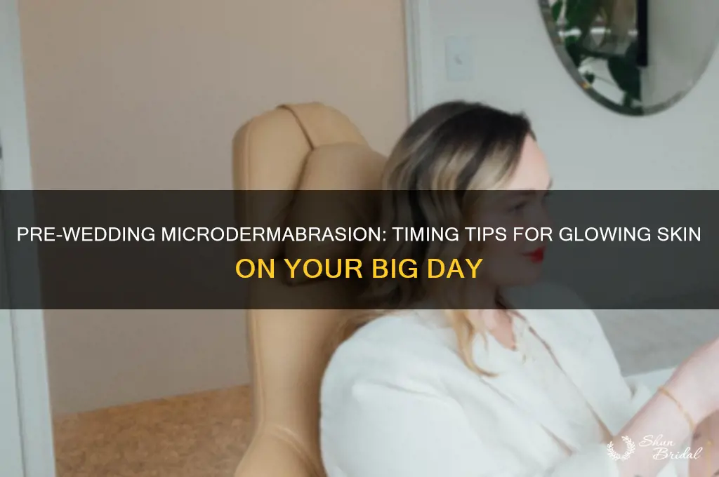 how far before wedding do microderm