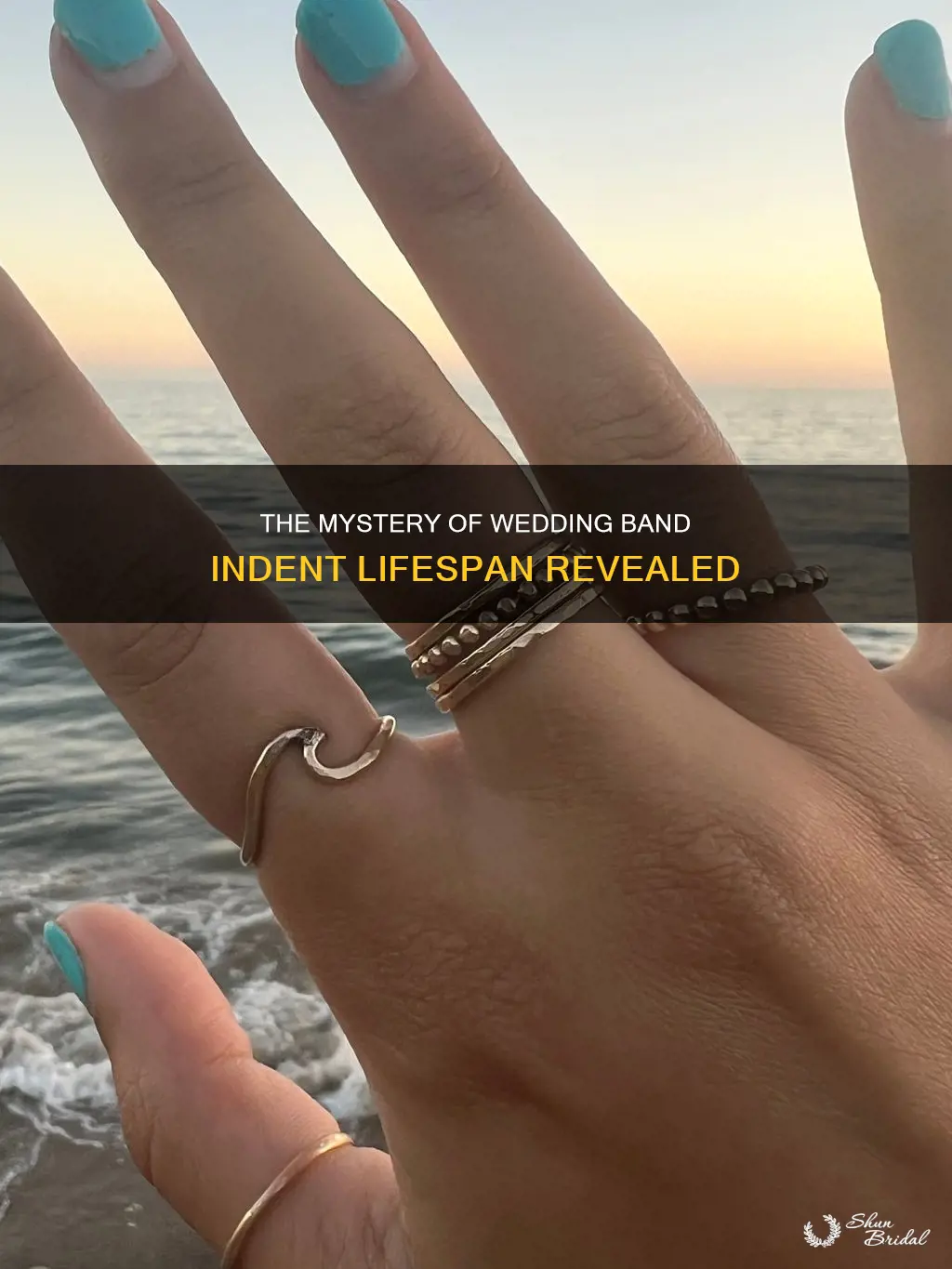 how long before a wedding band indent goes away