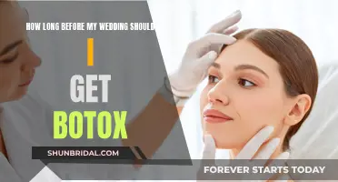 Months Before the Wedding: The Best Time for Botox