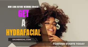 The Perfect Bridal Glow: Timing Your HydraFacial