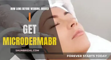 Planning Microdermabrasion for Your Wedding: Timing and Tips