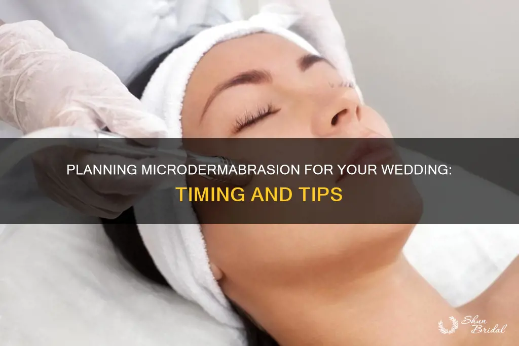 how long before wedding should I get microdermabrasion