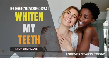 Teeth Whitening Timeline: When to Start for Your Wedding Day