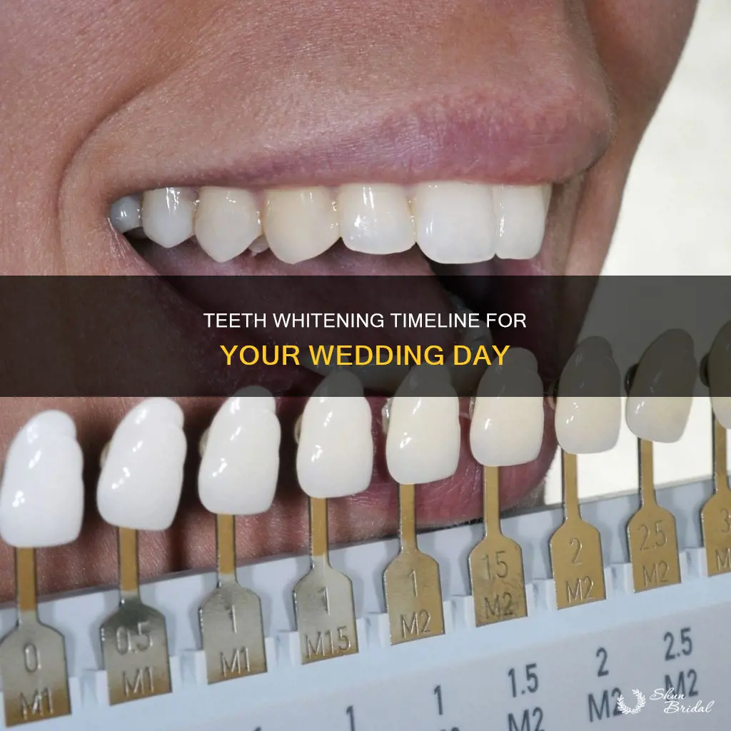 how long before wedding should I whiten my teeth