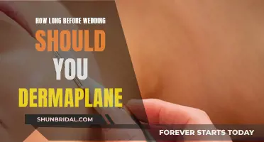 The Ideal Time to Dermaplane Before Your Wedding