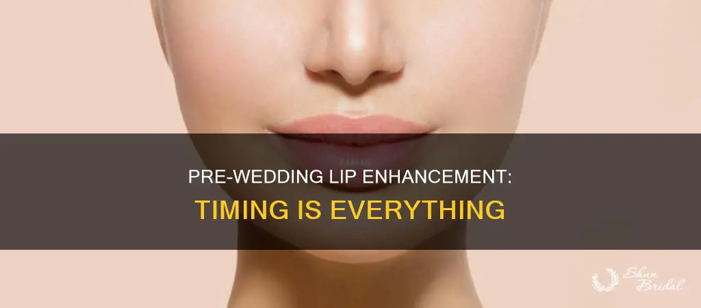 how long before wedding to get lip filler