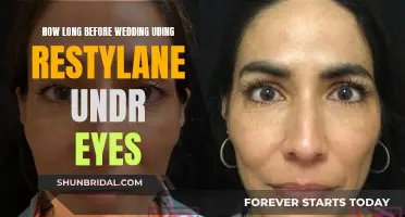 Wedding-Ready: Restylane Under Eyes, How Long to Wait?