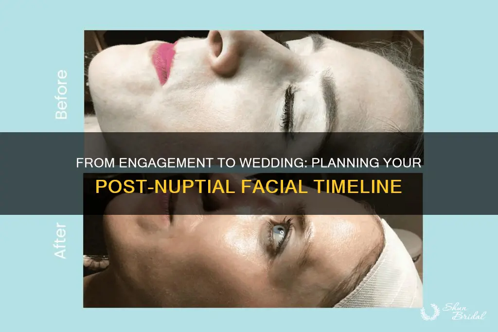 how long to wait from engagement to wedding to facial