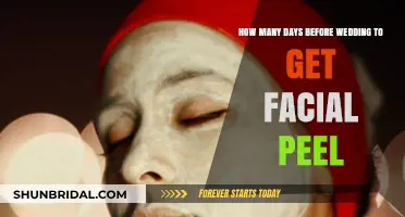 Perfect Timing for a Facial Peel Before Your Wedding Day