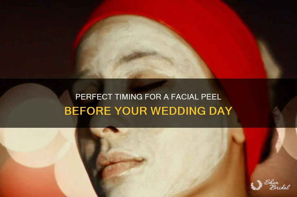 how many days before wedding to get facial peel