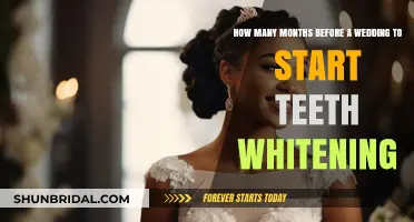 When to Start Teeth Whitening for Your Wedding Day Smile