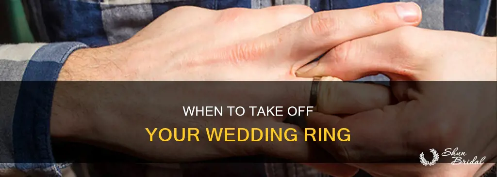 how often do you take off your wedding ring