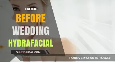 When to Schedule a Hydrafacial Before Your Wedding Day