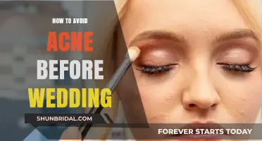 Glowing Skin for Your Big Day: Preventing Acne Before Your Wedding
