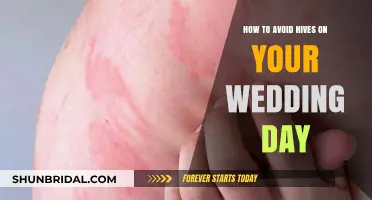 Prevent Wedding Day Hives: Tips for a Stress-Free, Radiant Celebration
