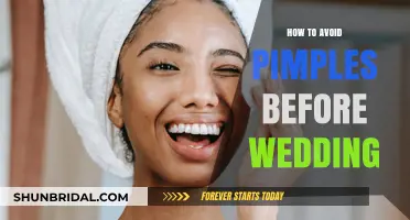 Glowing Skin for Your Big Day: Preventing Pimples Before Your Wedding