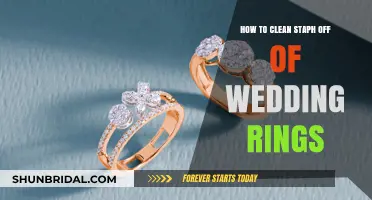 Cleaning Staph Off Wedding Rings: A Step-by-Step Guide