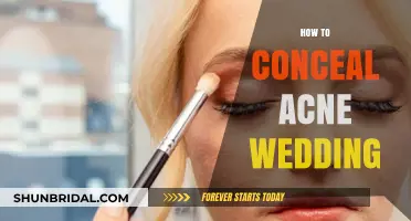 Flawless Wedding Day Skin: Expert Tips to Conceal Acne Effortlessly