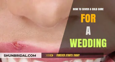 Conceal Cold Sores Flawlessly for Your Wedding Day: Expert Tips