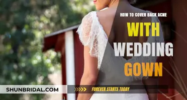 Concealing Back Acne: Tips for a Flawless Wedding Gown Look