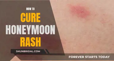 Honeymoon Rash: Remedies for Newlyweds' Itch