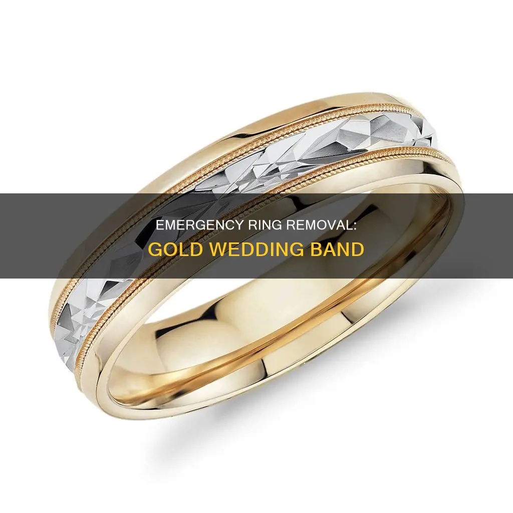 how to cut a gold wedding band off