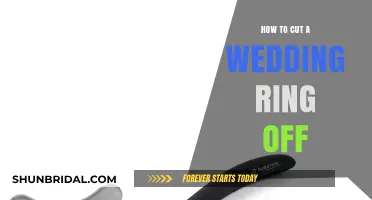 Emergency Wedding Ring Removal: Quick and Safe Methods