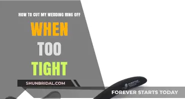 Wedding Ring Too Tight? Here's How to Cut it Off