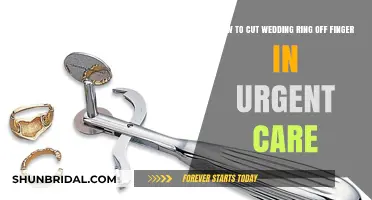 Emergency Ring Removal: Cutting Off a Wedding Ring