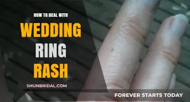 Wedding Ring Rash: Simple Solutions for Sensitive Skin