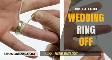Removing Stuck Wedding Rings: Quick and Safe Methods