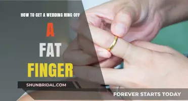Removing Wedding Rings: Fat Fingers, No Problem