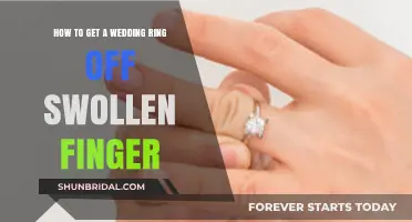 Emergency Ring Removal: Swollen Finger Solutions