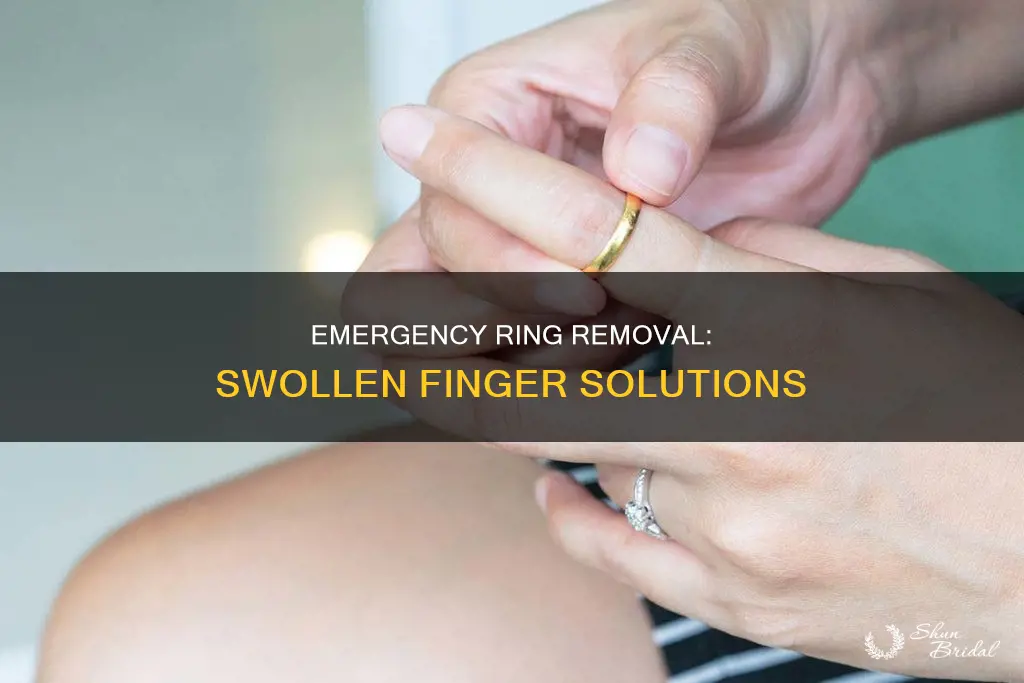 how to get a wedding ring off swollen finger