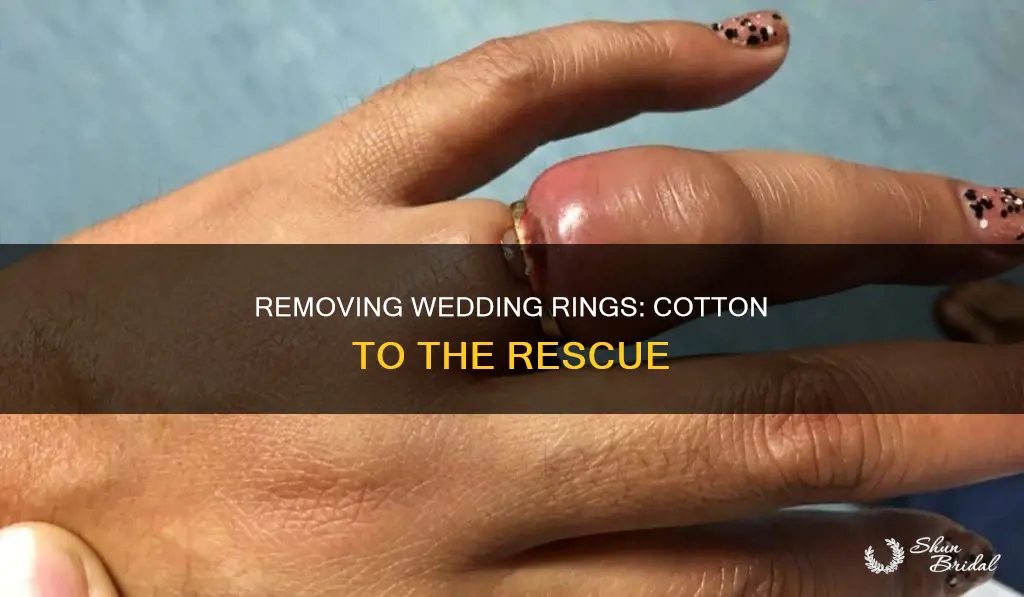 how to get a wedding ring off with cotton