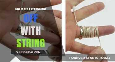 Emergency Ring Removal: String Method to the Rescue