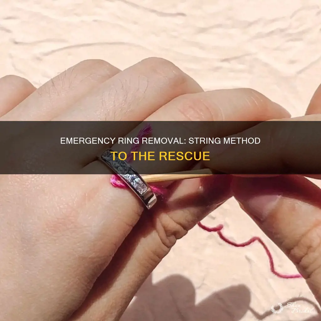 how to get a wedding ring off with string