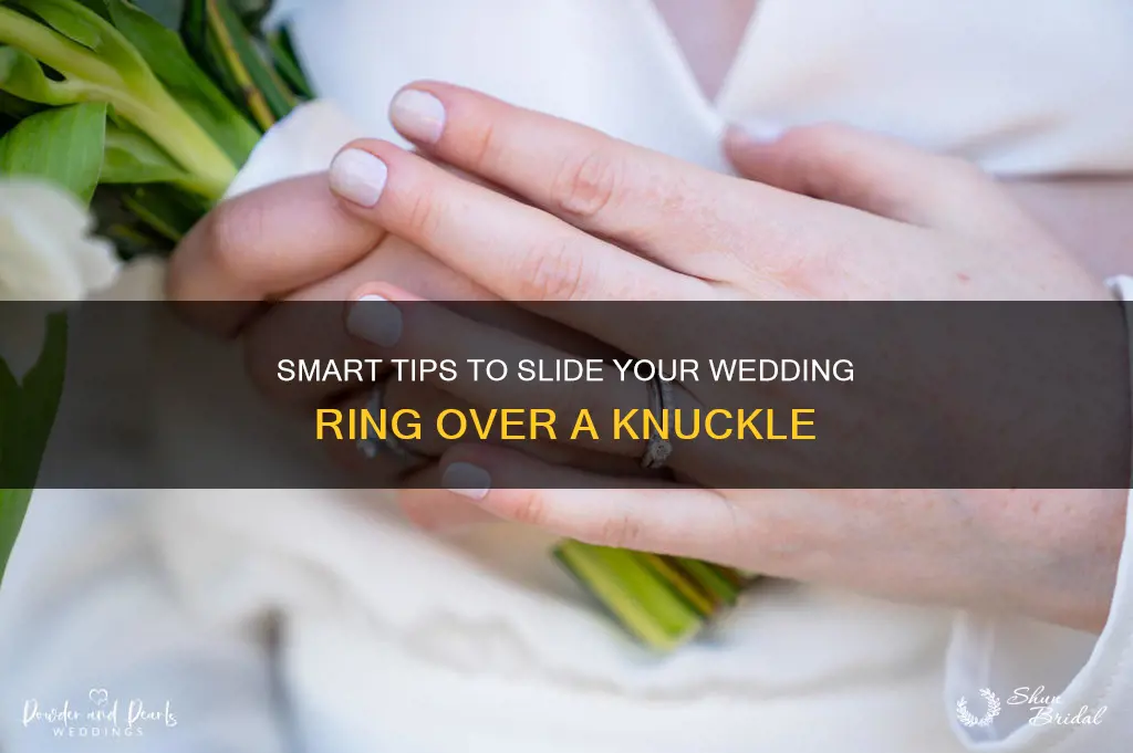 how to get a wedding ring on over a knuckle