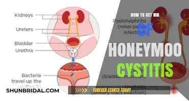 Effective Remedies to Treat Honeymoon Cystitis and Restore Comfort Fast