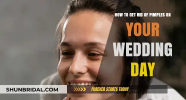 Quick Fixes for Wedding Day Pimples: Clear Skin Solutions