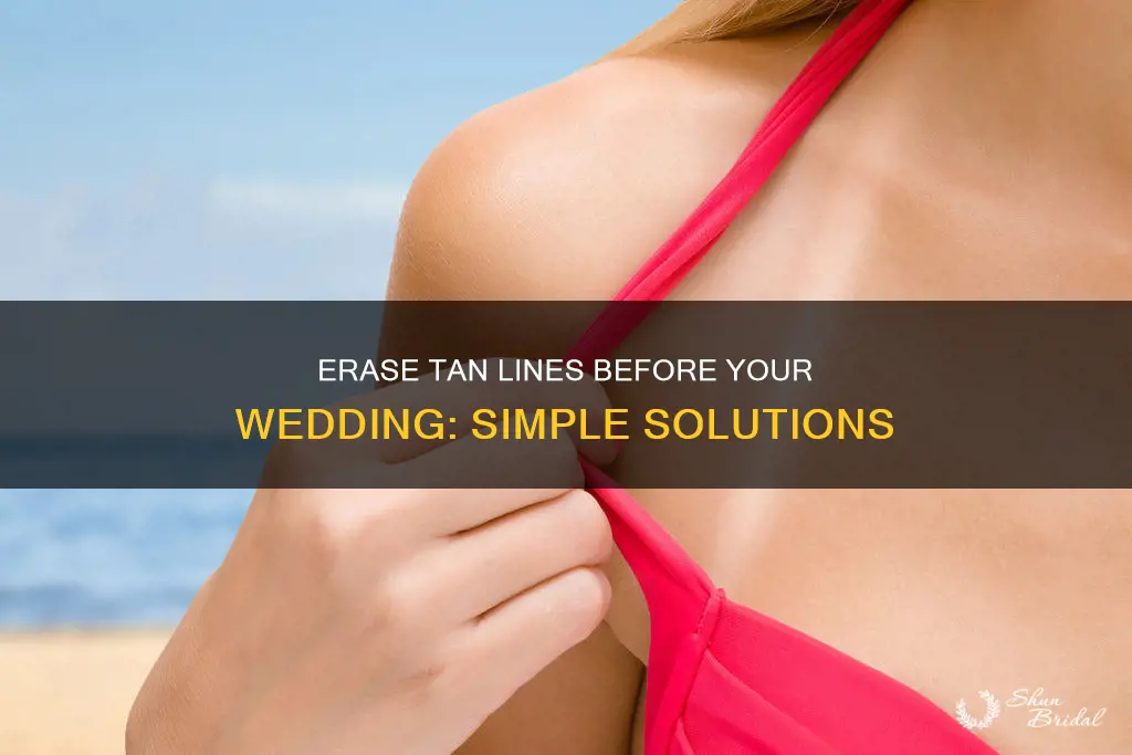how to get rid of tan lines for wedding dress