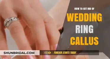 Erase Calluses: Tips for Smooth Skin After Wedding Ring Removal