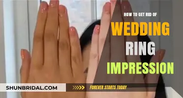 Erase Wedding Ring Impressions: Quick, Easy Solutions