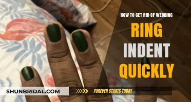 Erase That Ring Dent: Quick and Easy Solutions